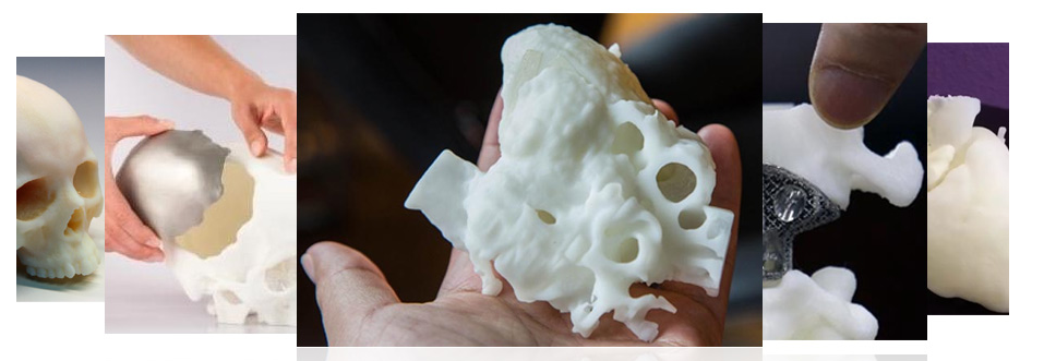 3D打印在医疗上的应用